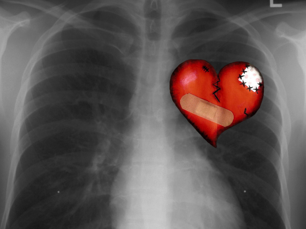 Chest x Ray powerpoint background